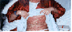 Stomach